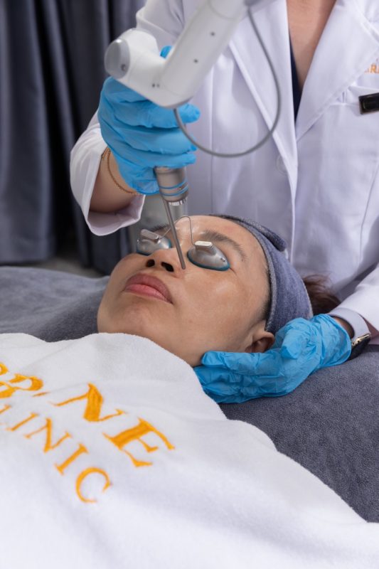 TRẺ HOÁ VÙNG MẮT