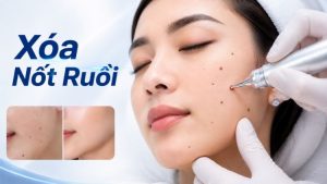 xoá nốt ruồi