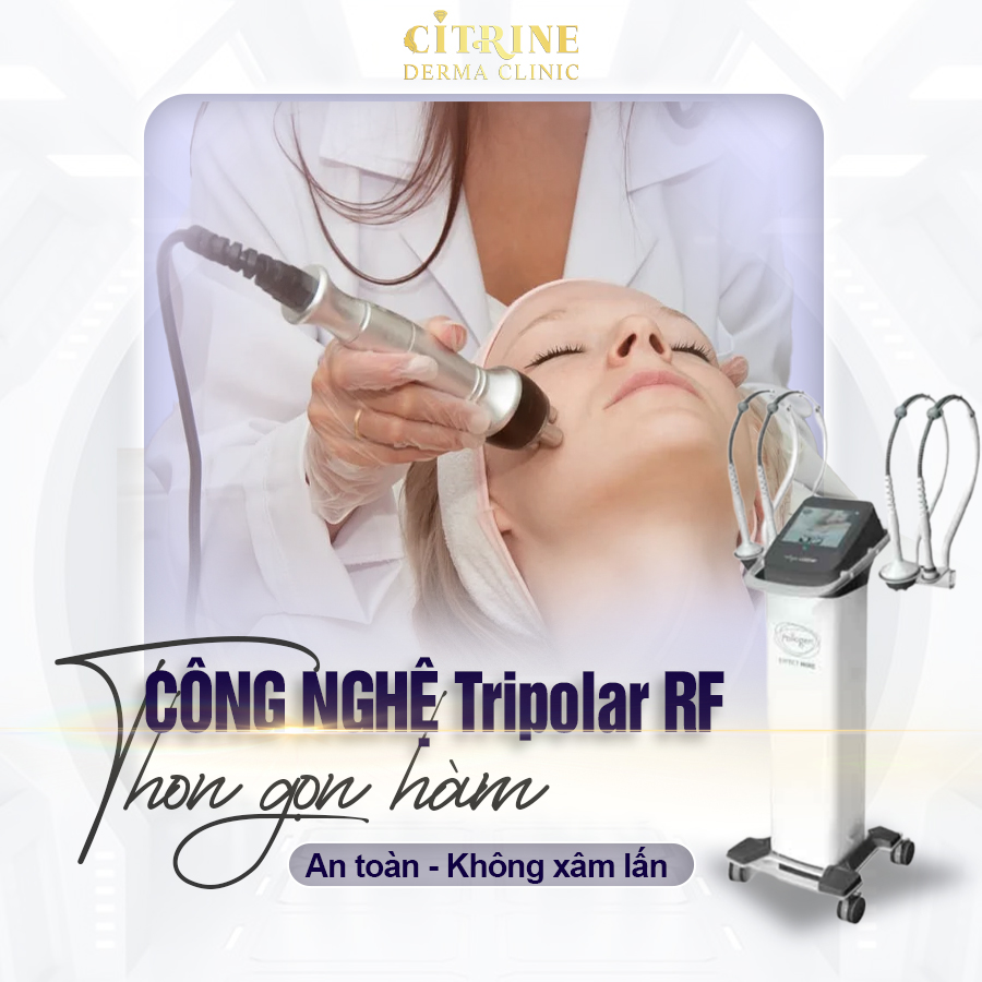 RF Giảm mỡ siết cơ