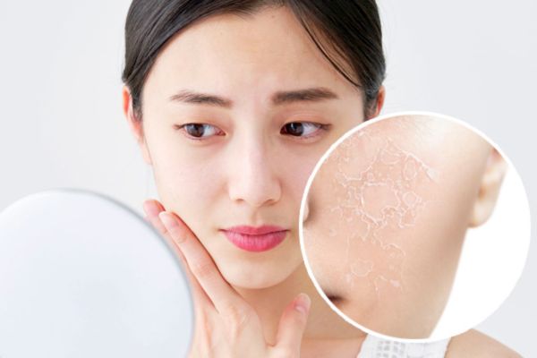 Có nên thử công nghệ cao trong điều trị nám da