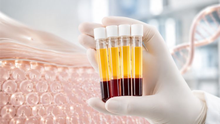 Cơ chế hỗ trợ phục hồi da của PRP ngoại sinh