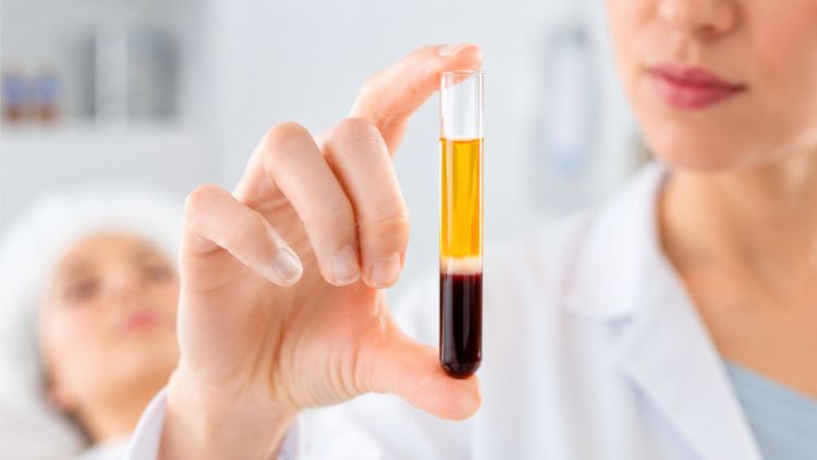 PRP ngoại sinh chế phẩm yếu tố tăng trưởng
