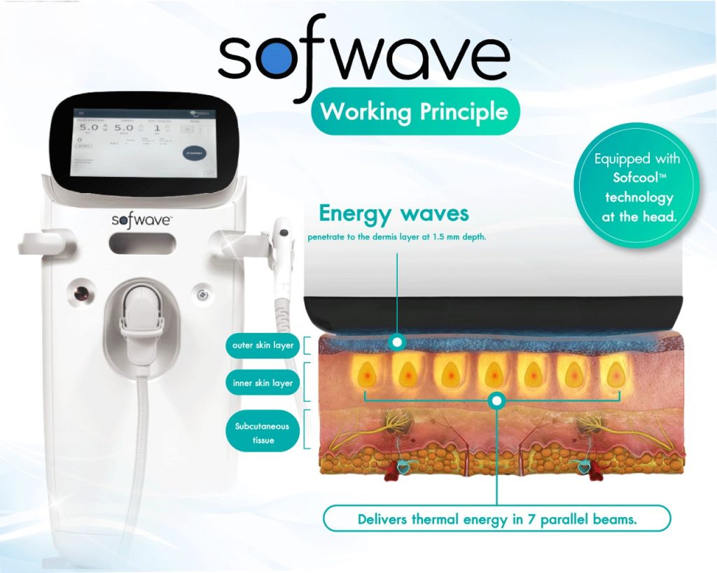 Sofwave - Công Nghệ Nâng Cơ Thế Hệ Mới- Hiệu Quả Ngay Sau 1 Lần Điều Trị