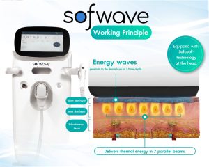 Sofwave - Công Nghệ Nâng Cơ Thế Hệ Mới- Hiệu Quả Ngay Sau 1 Lần Điều Trị