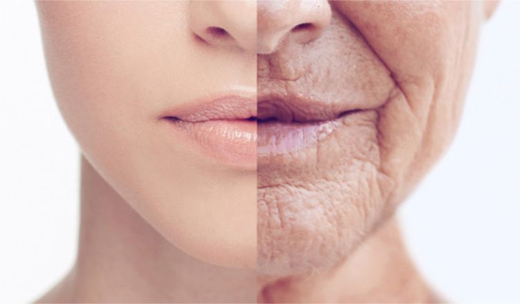 Da chùng nhẹ đến vừa là nhóm tình trạng thường được cân nhắc HIFU