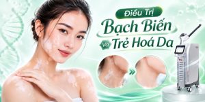 điều trị bạch biến và trẻ hoá da