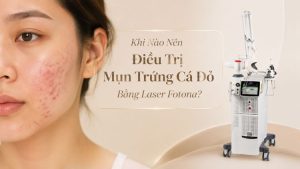 Điều trị mụn trứng cá đỏ bằng laser fotona