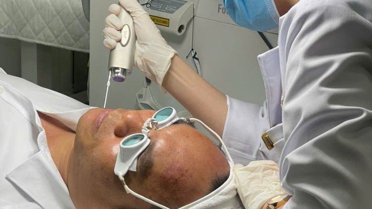 Thời điểm phù hợp để cân nhắc điều trị bằng Laser Fotona 