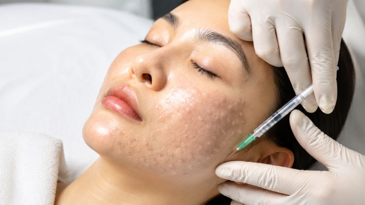 Tiêm Meso có tác dụng gì với nền da
