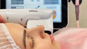 HIFU Liftera là gì