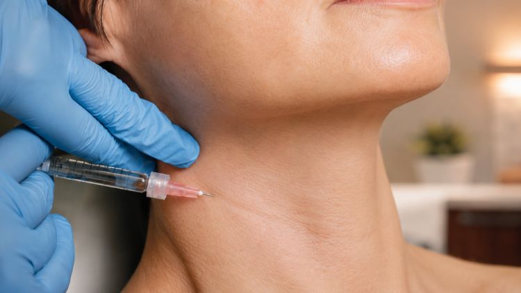 Filler cho rãnh nhăn cổ hằn sâu