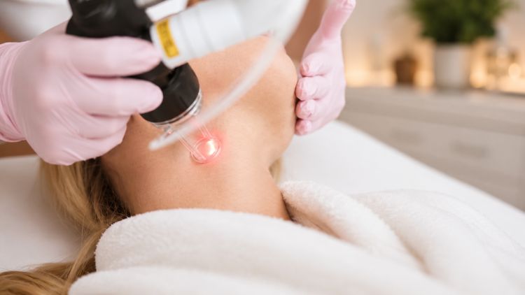 Laser cho da cổ xỉn màu, không đều màu