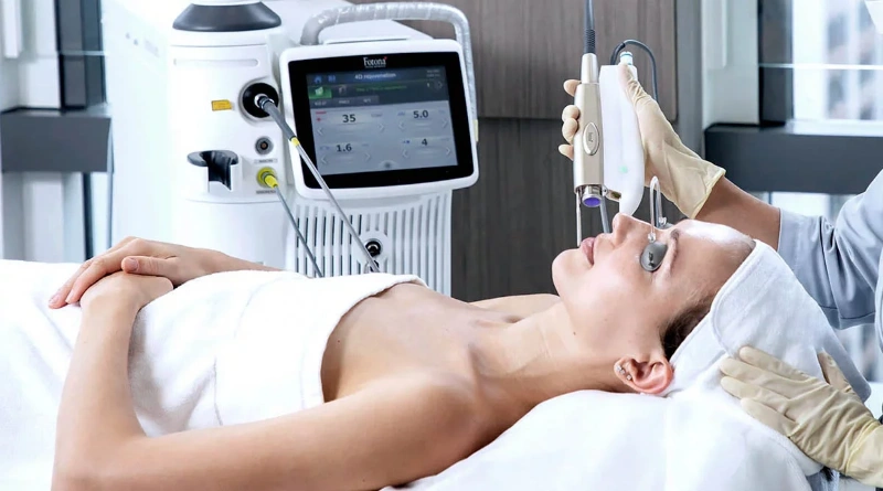 Công nghệ Laser Fotona triệt lông là gì?