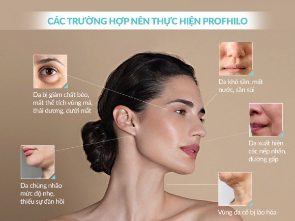 Các trường hợp nên tiêm Profhilo