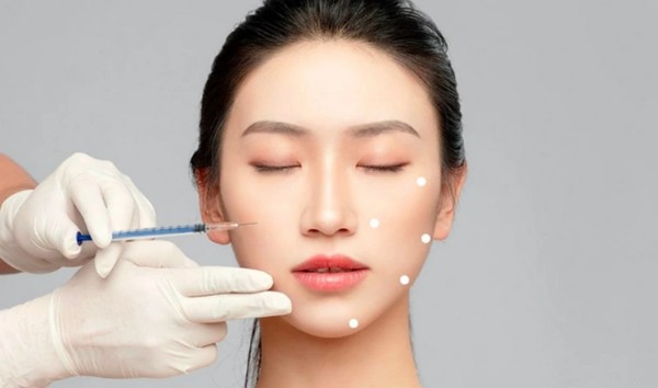 Kỹ thuật BAP trong liệu trình tiêm Profhilo 