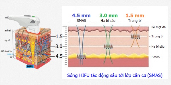 Nguyên lý hoạt động của Hifu