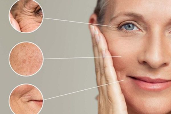 Laser Fotona phù hợp nâng cơ trẻ hóa da, không áp dụng cho mọi đối tượng