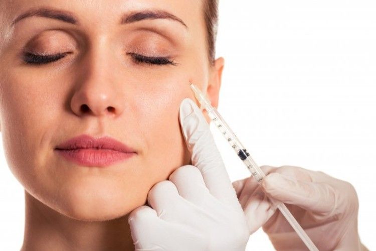 Botox Microdoses – Nâng cơ không phẫu thuật