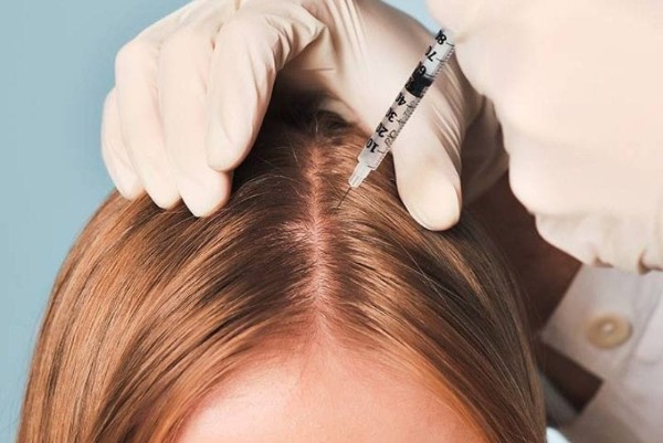 Vai trò phục hồi nền tóc trong điều trị rụng tóc