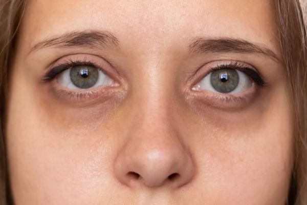 tham quang mat do tang sac to