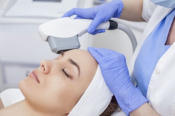 IPL điều trị mụn giúp giảm viêm, diệt khuẩn và cải thiện thâm da hiệu quả