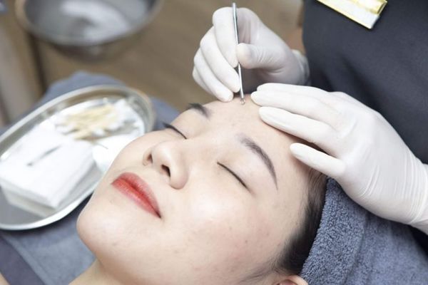Điều trị mụn là can thiệp y khoa giúp kiểm soát mụn và ngăn ngừa sẹo
