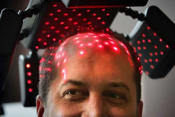 Điều trị rụng tóc công nghệ cao kích thích nang tóc, hỗ trợ mọc tóc hiệu quả