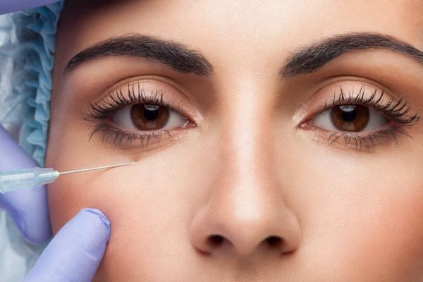 filler tham quang mat la gi