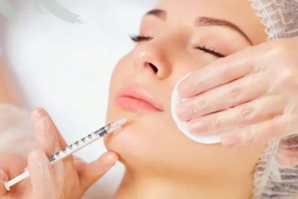 tiem filler giup moi dep tu nhien