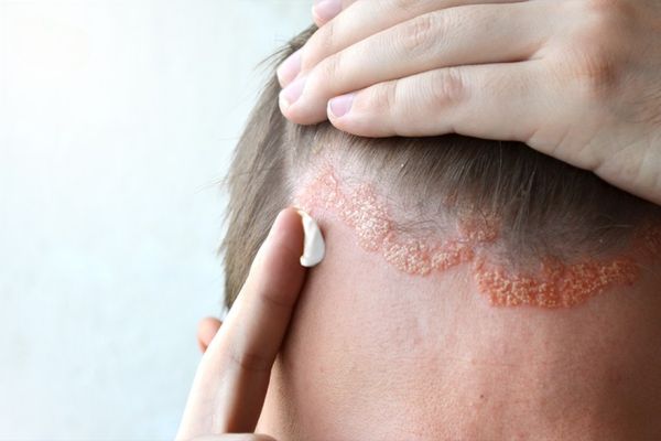 vay nen thuong xuat hien o dau