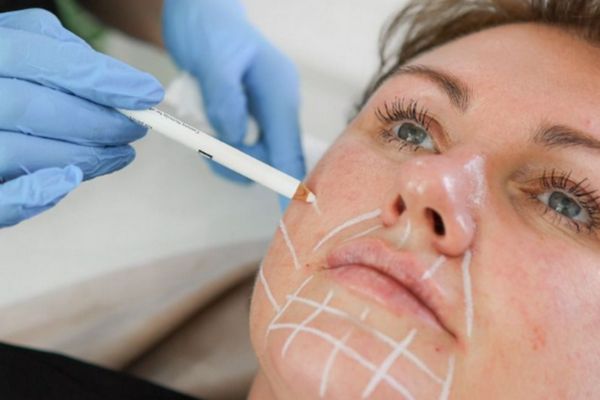 chi phi lieu trinh tiem jalupro