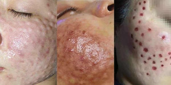 Biến chứng nghiêm trọng