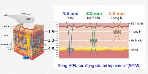 Cơ chế tác động của công nghệ HIFU đến da