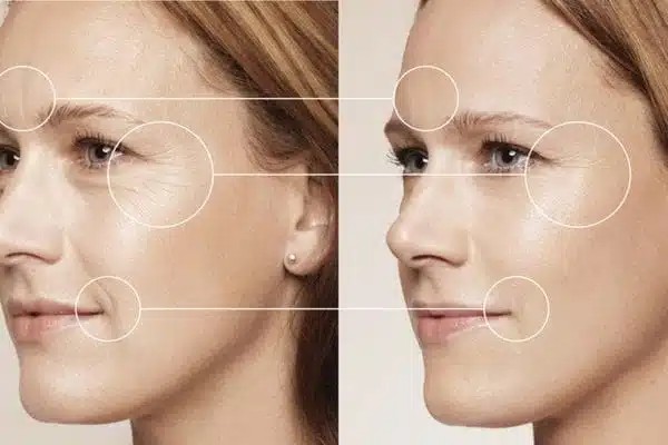 Độ tuổi và mức độ lão hóa ban đầu