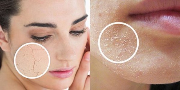 Liệu pháp căng bóng da này phù hợp với những ai