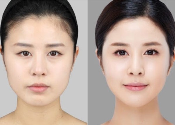 Lộ trình thay đổi theo từng giai đoạn