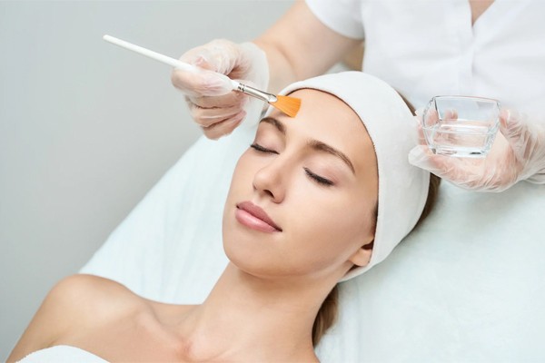 Phương pháp peel da trị mụn giúp làm sạch sâu lỗ chân lông