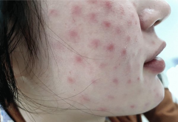 Tác hại trung bình