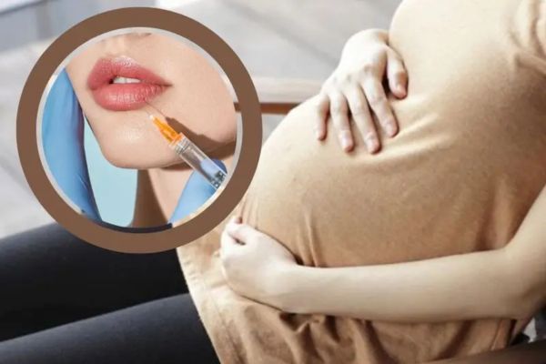 Tiêm filler môi phù hợp khi đủ điều kiện sức khỏe và không có chống chỉ định