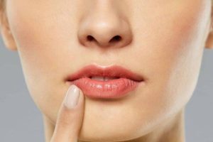 cách chăm sóc môi sau khi tiêm filler