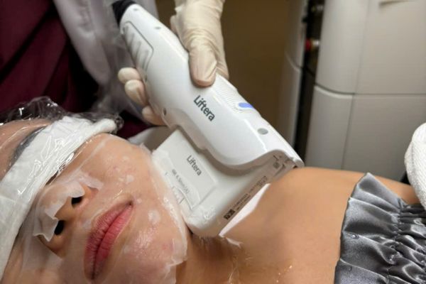 Hiệu quả HIFU tối ưu khi thực hiện tại cơ sở uy tín và chuyên sâu