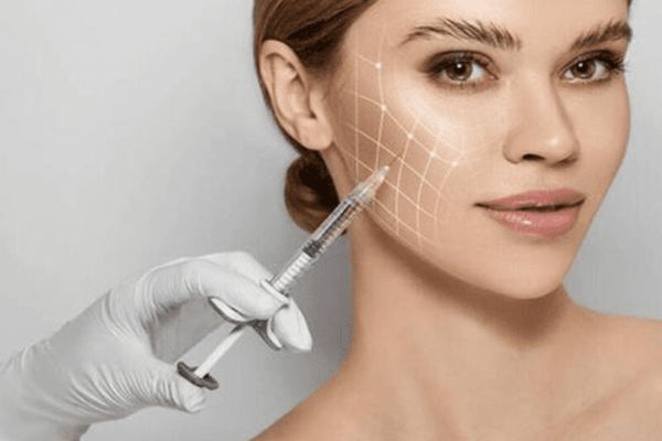 Filler má hóp giúp làm đầy má lõm, trẻ hóa gương mặt tự nhiên