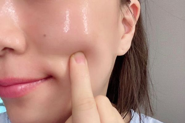 Sau vài ngày, da mịn hơn, căng bóng và bắt đầu cải thiện rõ rệt