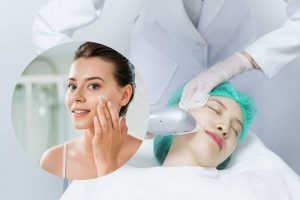 sau khi làm HIFU kiêng gì