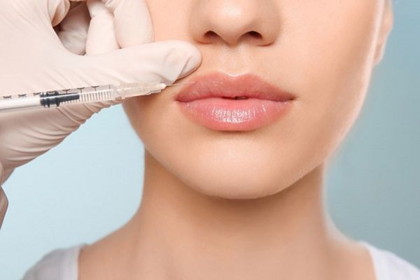 Tiêm filler môi an toàn nếu đúng kỹ thuật và chọn cơ sở uy tín