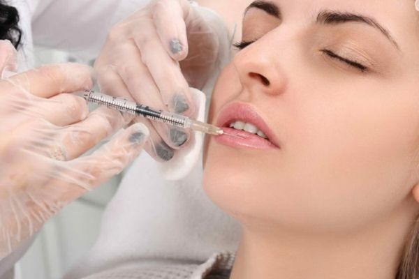 Tiêm filler môi là phương pháp làm đầy môi an toàn, không phẫu thuật