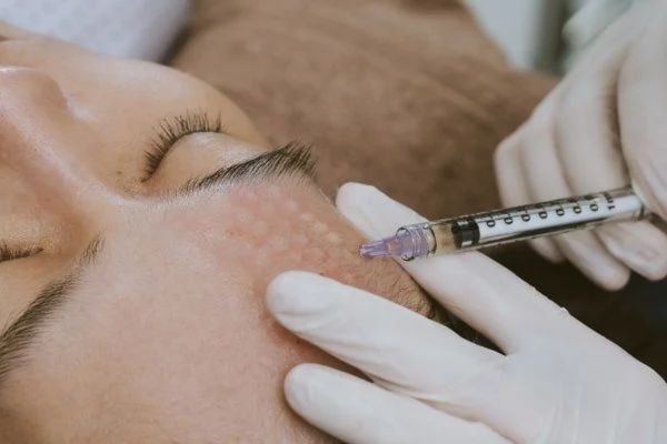 Citrine Derma Clinic cung cấp tiêm meso an toàn, chuẩn y khoa