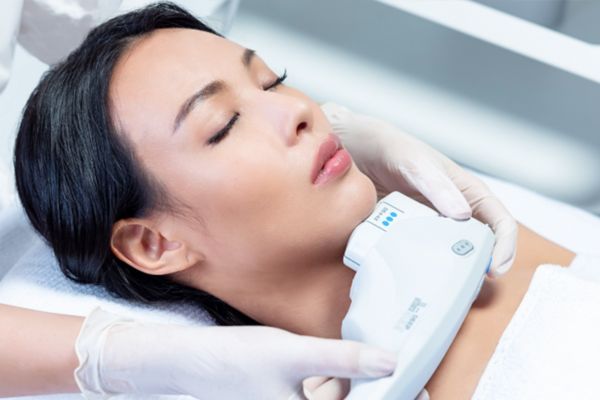 Việc kết hợp căng da cổ tùy thuộc nguyên nhân nọng cằm và độ đàn hồi da