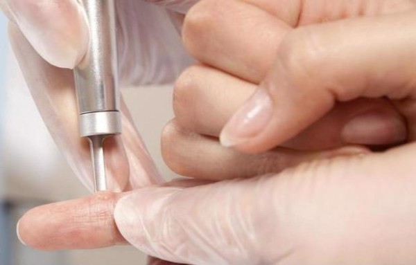 Có thể điều trị mụn cóc bằng các phương pháp nào