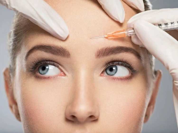 tiêm botox xóa nhăn trán